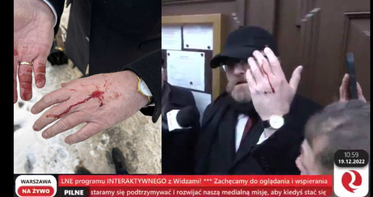 MEGA protest w Krakowie w obronie dr. Zbigniewa Martyki. Braun został raniony!